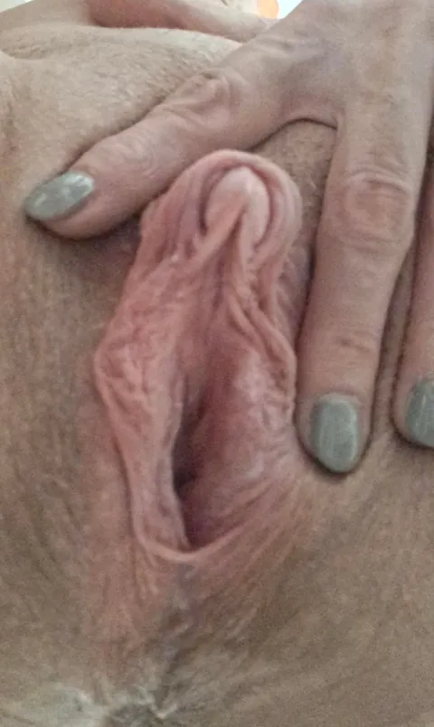 51 clit needs attention