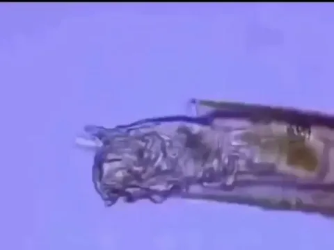This microorganism has chainsaw like mouth.