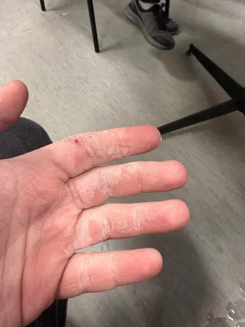 Dry Air + Constantly working with cardboard boxes