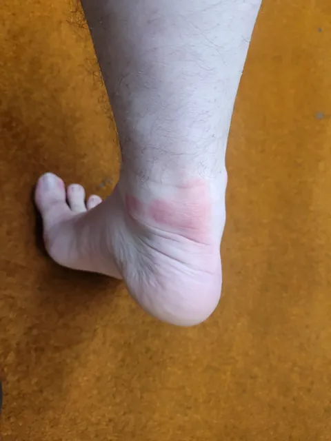 My family says I have 'sugar blood'