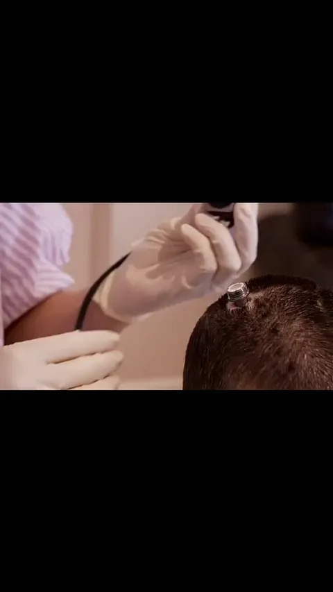 This brain implant and digital avatar allowed Ann, who survived a stroke, to speak again with facial expressions for the first time in 18 years.