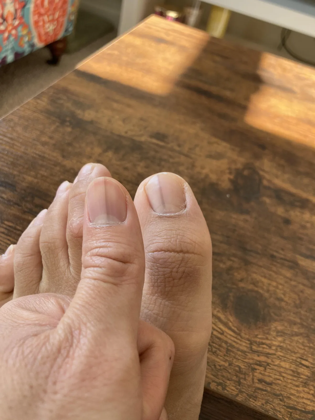 These black lines on my thumb and my toe