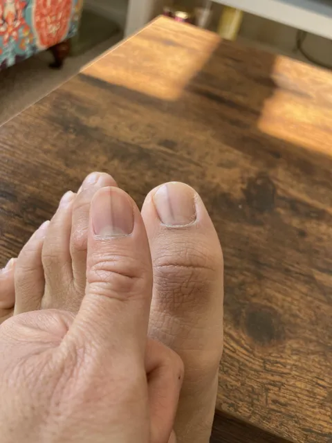 These black lines on my thumb and my toe