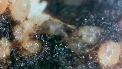 Got a new microscope and used it on my cat's ear mites