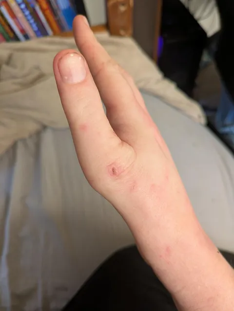 I can't bend my right thumb, so it never developed creases