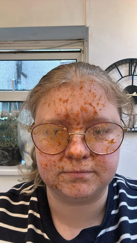 My canned curry sauce exploded in my face