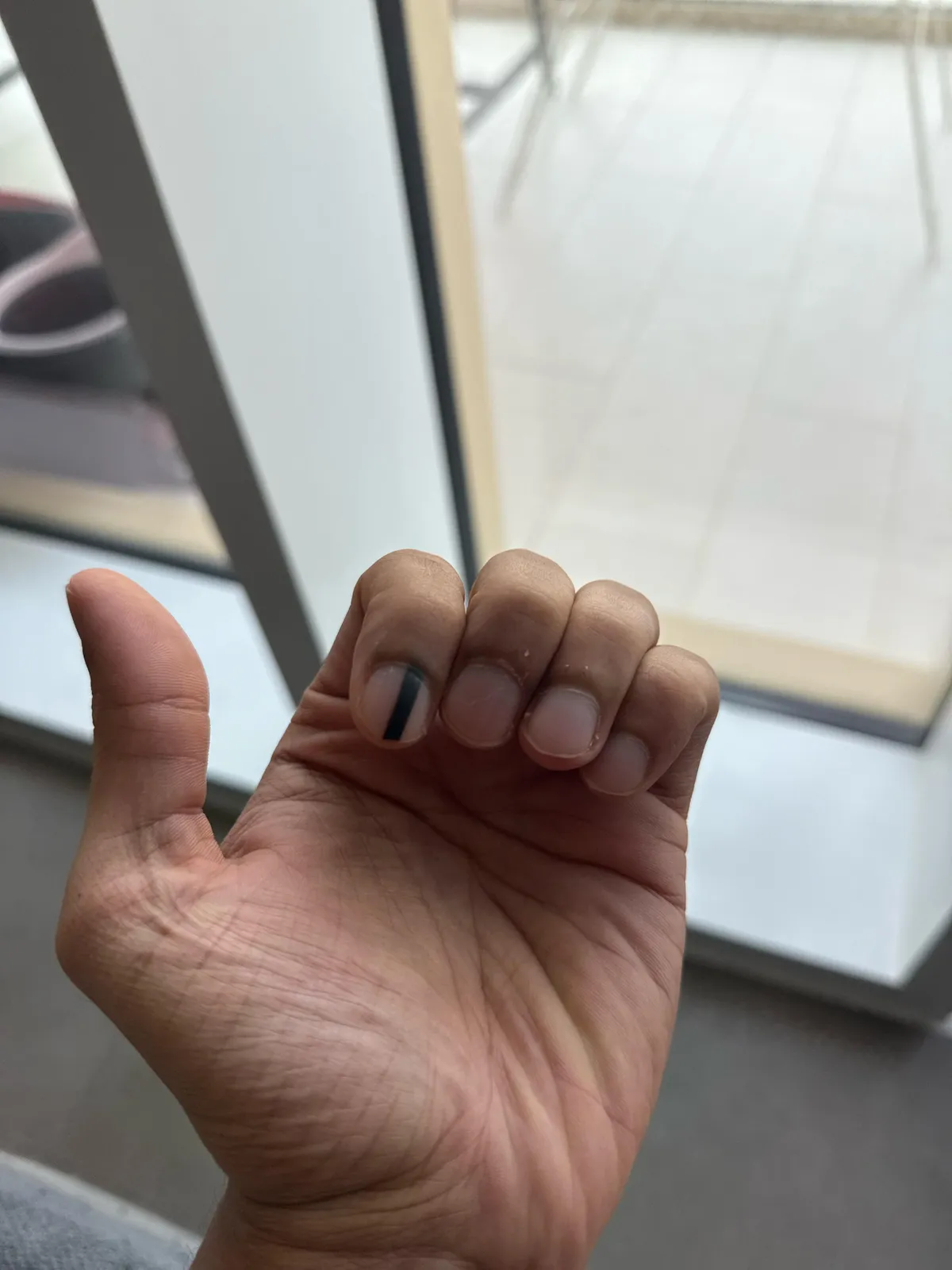 Mark on my finger that darkened over time