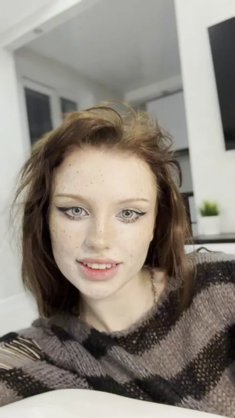 Freckles are a real swag