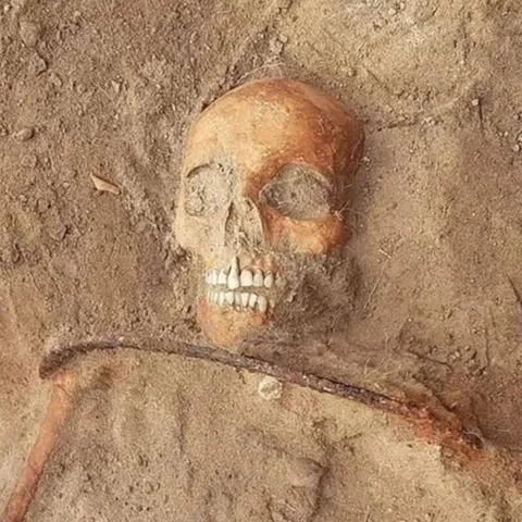 The Remains Of A Woman Accused Of Being A Vampire In 17th Century Poland, Who Was Buried With A Sickle Across Her Throat And A Padlock On Her Feet To Prevent Her 'Rising From The Dead'