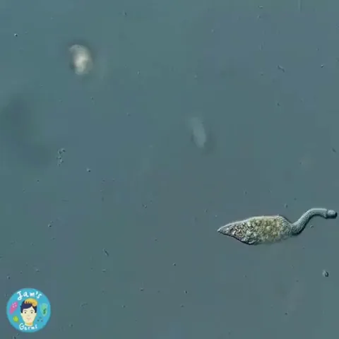 🔥 Vicious microscopic hunter, the single-cell organism, Lacrymaria olor, attacking and hunting another organism
