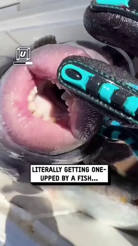 The mouth of a triggerfish looks almost human