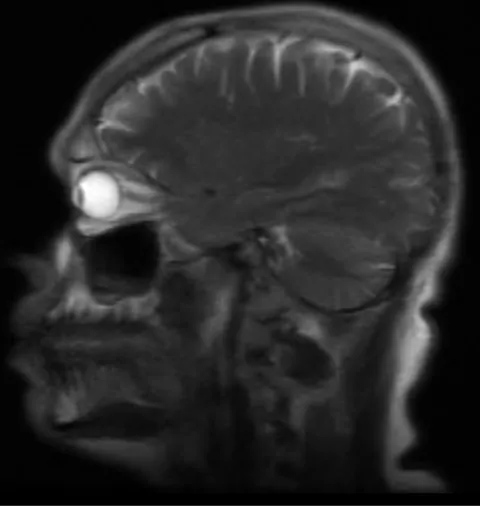 So I had an MRI last week and, kinda scary.