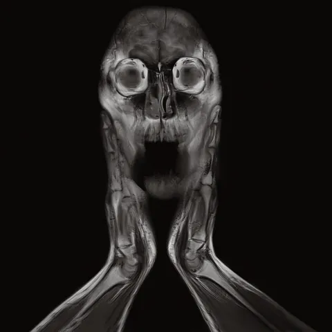 [oc] anatomy of a scream,mri image acquired by me during machine testing