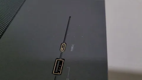 What are these guys and how can I get rid of it?