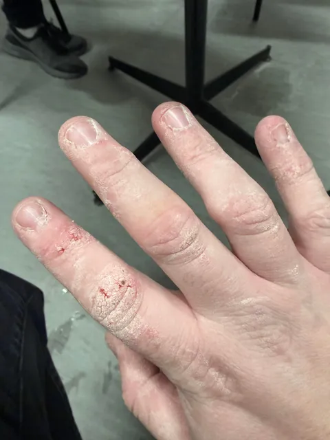 Dry Air + Constantly working with cardboard boxes