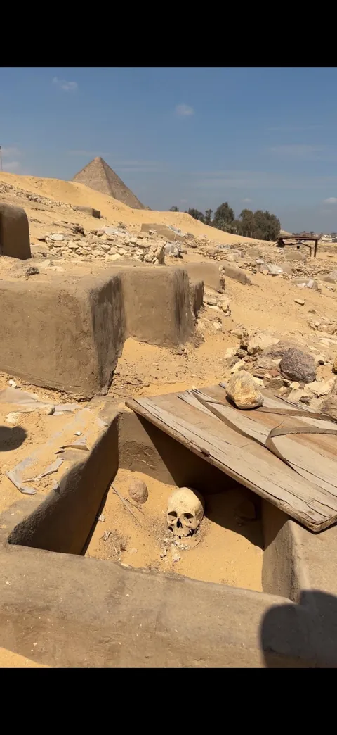 Skull of an ancient worker at the Giza Plateau, Egypt