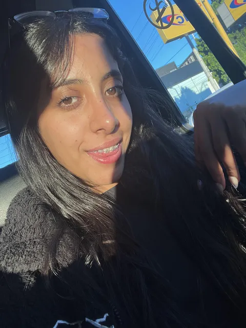 I hope you also like the color of my braces 