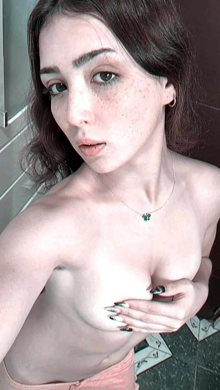 Am I hot with freckled faced F18