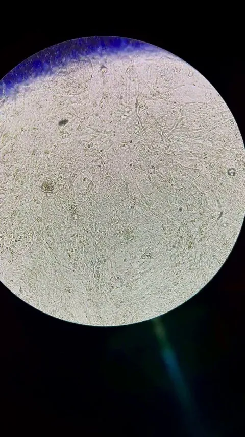 What you’re seeing are individual, lab cultured cardiomyocytes (heart cells) on a well plate. They will find each other and begin to beat by themselves.