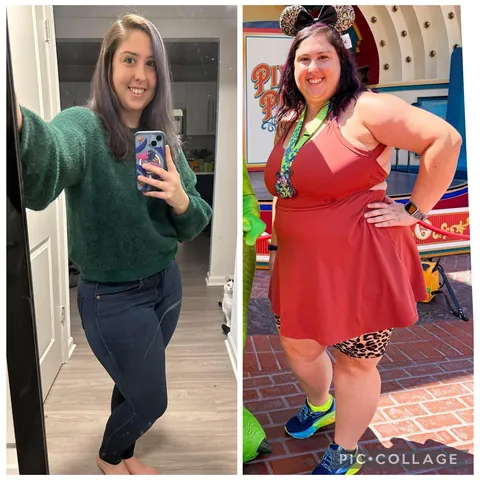 Fractured my pelvis due to a rare genetic condition. Gained almost 150 pounds. Doc says it healed fine but still hurts daily.