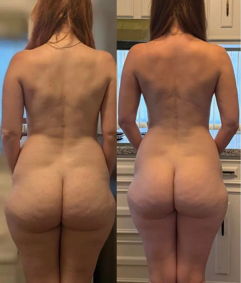 35yo mom (f). I lost ten pounds in the last six mos or so. Current is on the right. Which weight do you think is best for me? 150lbs vs 140lbs at 5’6”.