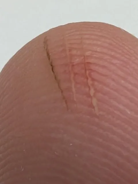 Stupidly picked up a screw while it was hot, now I have burn marks to match the thread