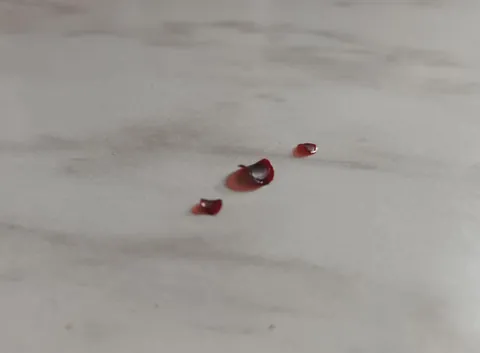 Left some blood droplets on the kitchen counter, overnight, they turned into a pringle shape
