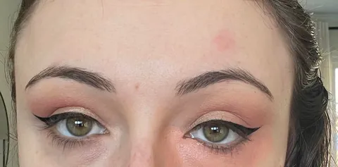 Color correcting doesn’t help my dark circles. Why?