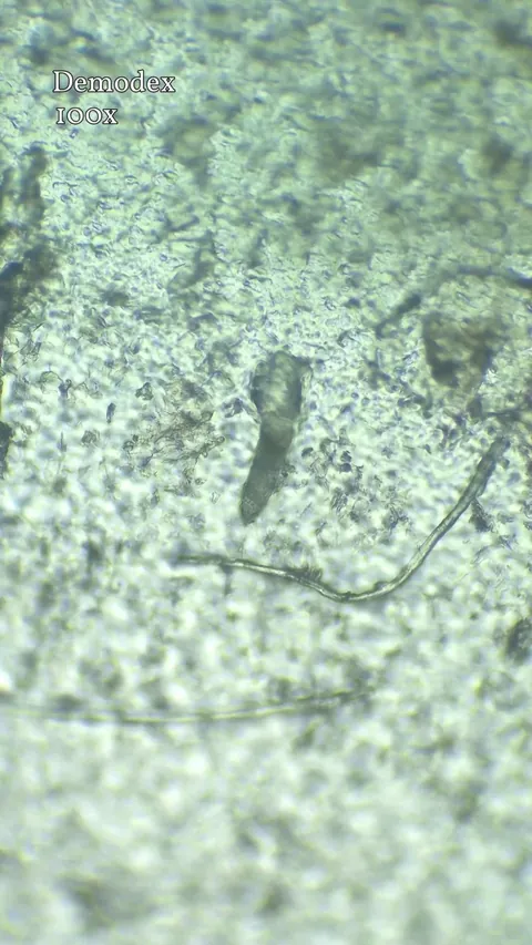 This is a demodex face mite. They live around our eyelashes, nose and forehead, eating skin cells and body oils.