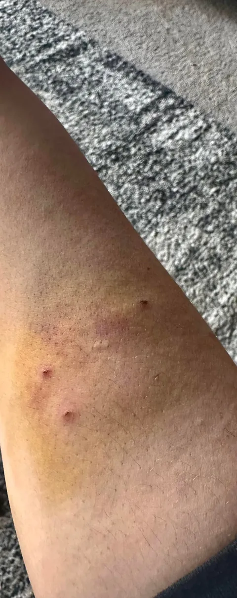 My cat had to get bloodwork done. Took 10 pokes to find a vein. 10th poke she bit my arm and shook like a damn alligator. Yes, that’s my blood on her. Yes I am on antibiotics. No, she is not normally an aggressive cat.