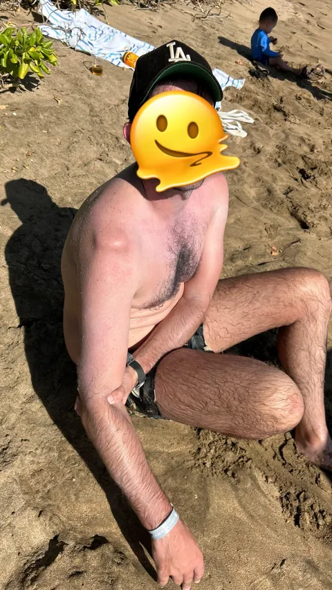 Dislocated shoulder while snorkeling with turtles in Maui