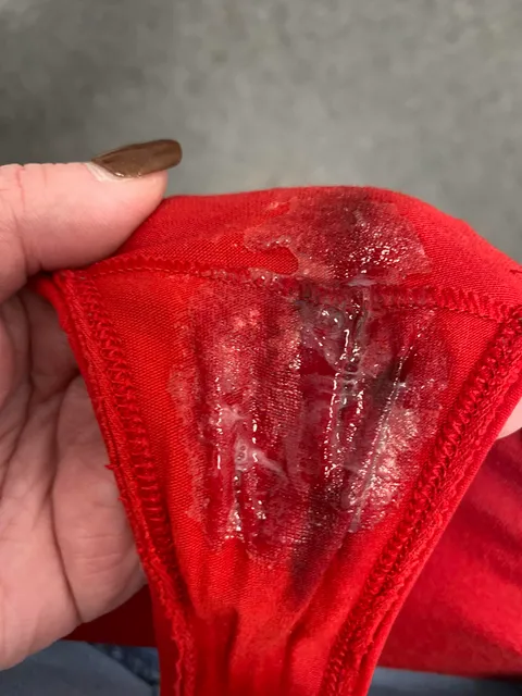 What happens when plugged at work after 60 days of denial.