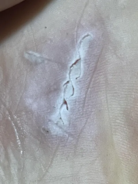 The pattern that a reef cut left on my foot