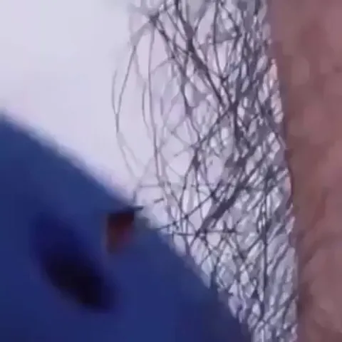 Body hair makes great protection against mosquito