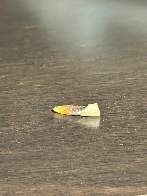 Tooth found in hotel closet 🦷
