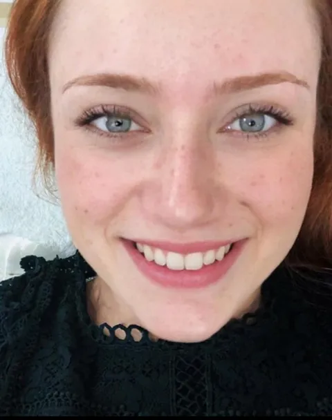 Almost 32 but not wearing makeup to show off my freckles 