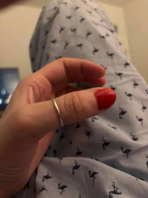 When you can’t use your thumb for 3 months, the creases go away!