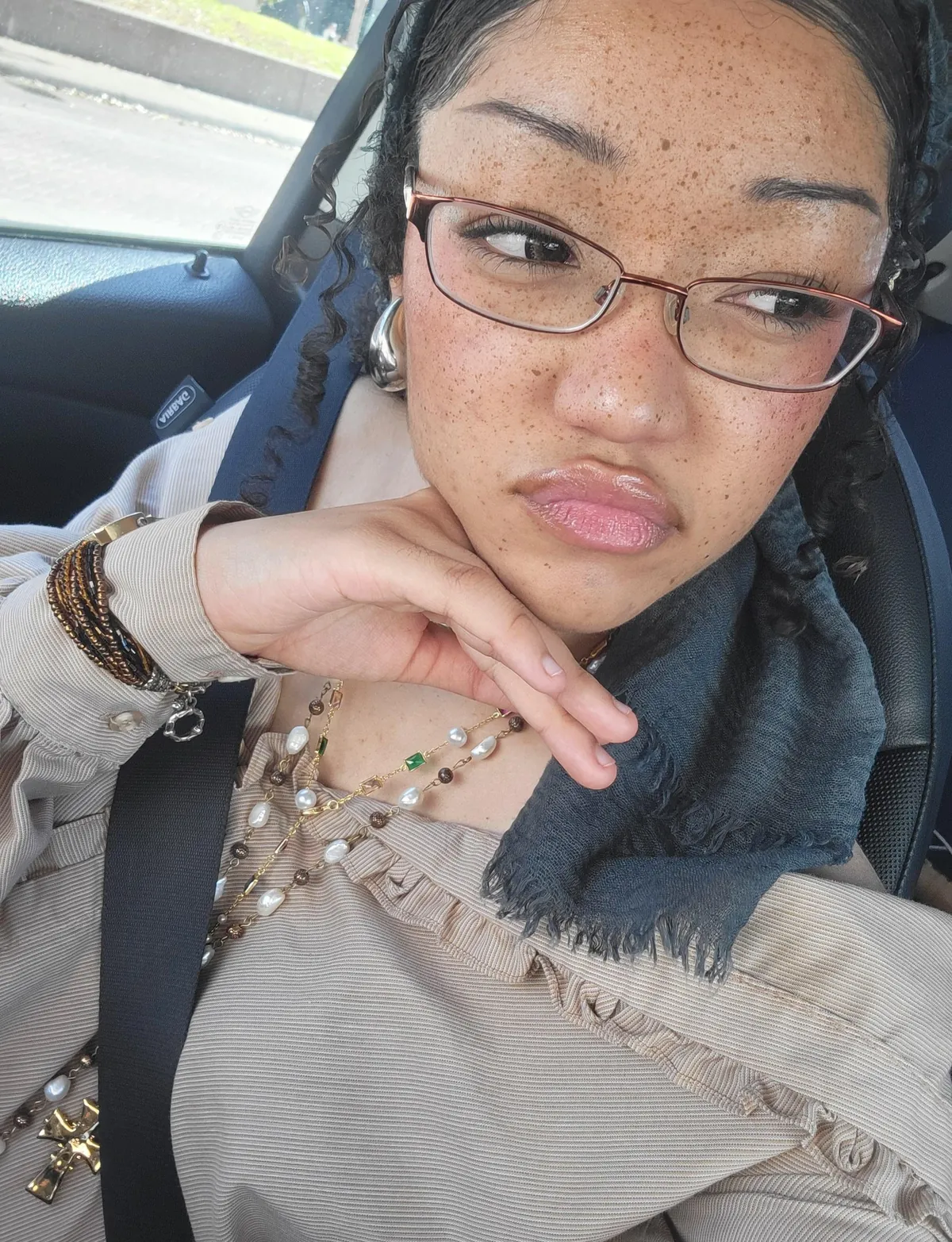 Ive been wearing fake freckles for a year instead of foundation as a way to hide acne scarring and improve my skin