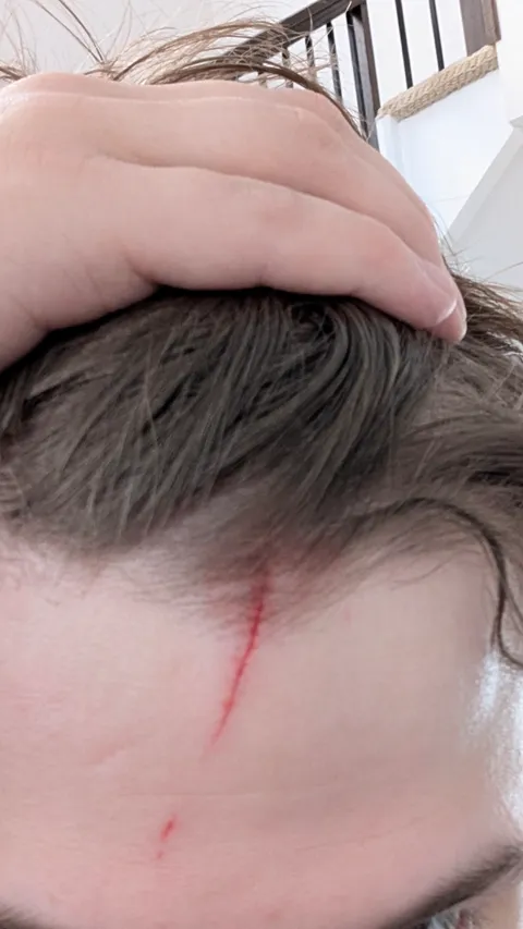 I smacked my head on the car door, I'm getting married friday