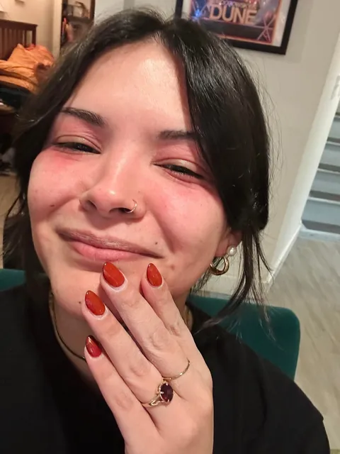 Watch my eyes blow up from the arnica in my concealer