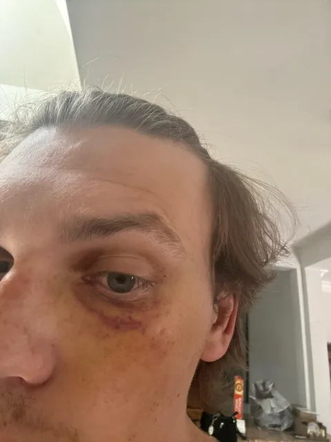 Job interview in 2 days. How cooked am I? Can I hid this?