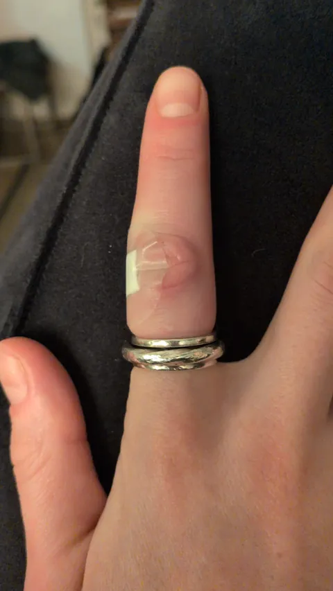 Cut my finger and now it's swollen and trapped my ring 😭