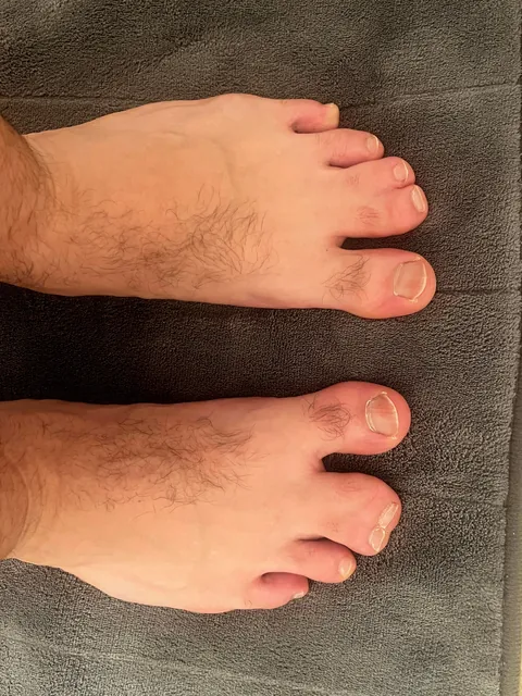 First time in 40 years revealing my webbed toes to the world!