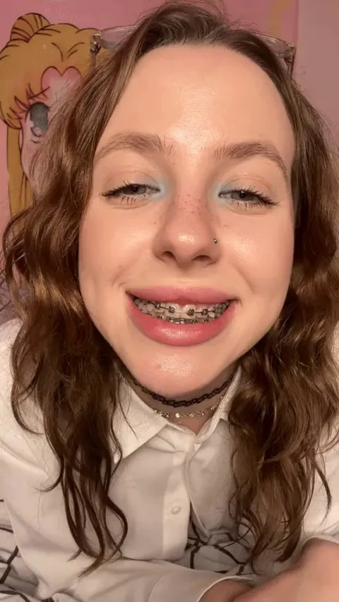 hehe trying to seduce you with my braces