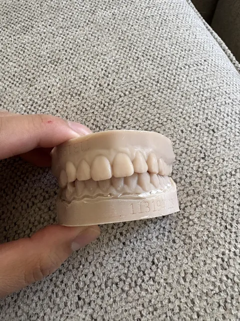 My dentist gave me a mold of my teeth