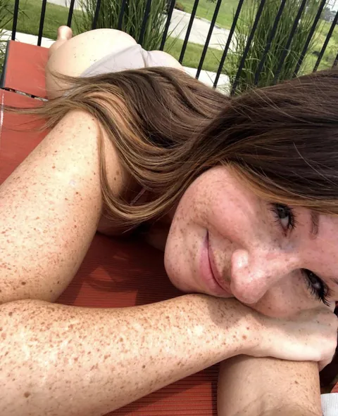So many summer freckles