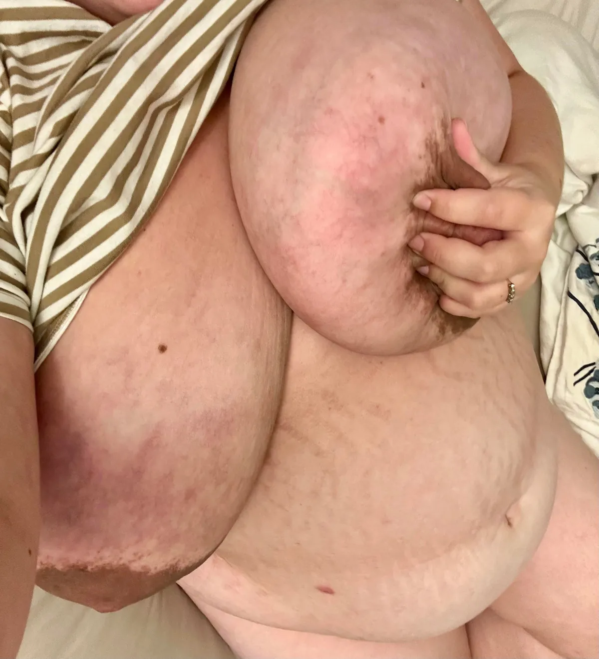 Someone help me to express my colostrum… they’re begging for it! 🥰