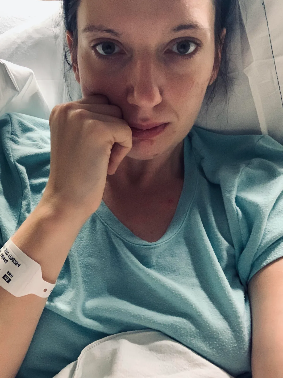 I just had a ruptured brain aneurysm and a brain bleed and had surgery and actually survived!!