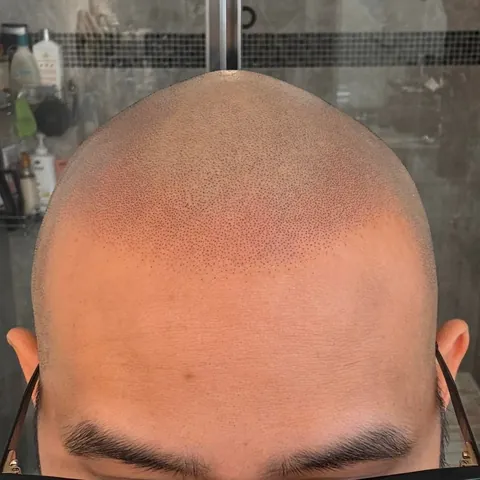 Got my head tattooed! 6 month healed > Fresh > Before