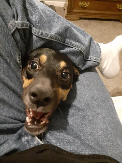 Every time I go to put my ankle on my knee to put on shoes, this happens...